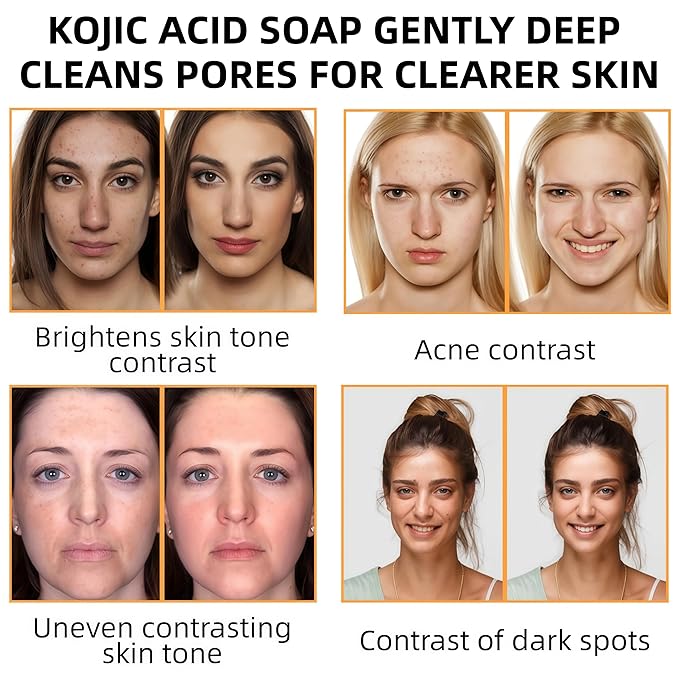 korabalm Turmeric Soap and Kojic Acid Dark Spot Remover Soap, 2PCS Brightening Face & Body Wash w/VC, Hyaluronic Acid & Shea Butter, Even Tone Skin Cleanser for Hyperpigmentation