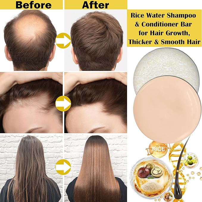 2 Pack Rice Water Shampoo and Conditioner Set for Hair Growth,Deep Cleansing for Scalp,Organic Protein & Vitamins for Damage Hair,Anti Hair Loss,Strengthen Hair Care for Volumizing,Smooth,Travel Soap
