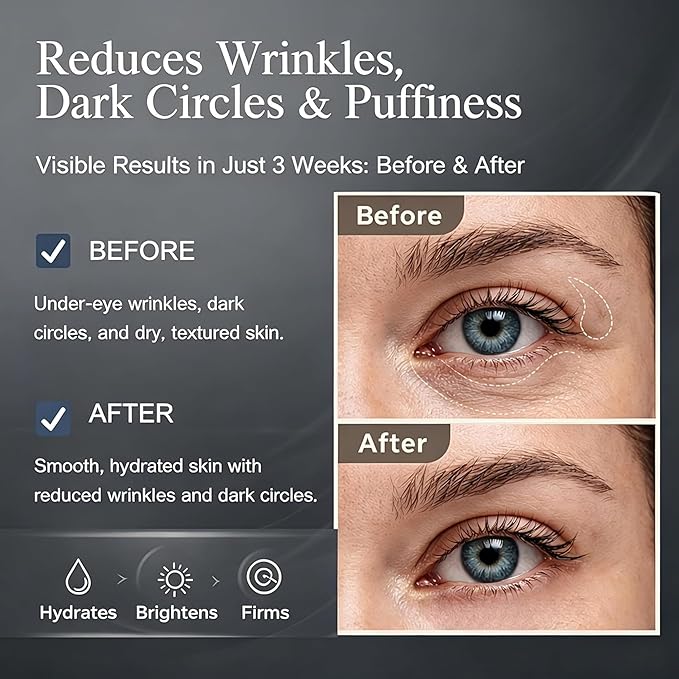 Retinol,Caffeine & Peptides Under Eye Serum, Fast Absorbing, Instant Firming,Correction for Puffy Eye Bags Fine Lines Dark Circles Wrinkles – Anti-Aging Wrinkle Remover