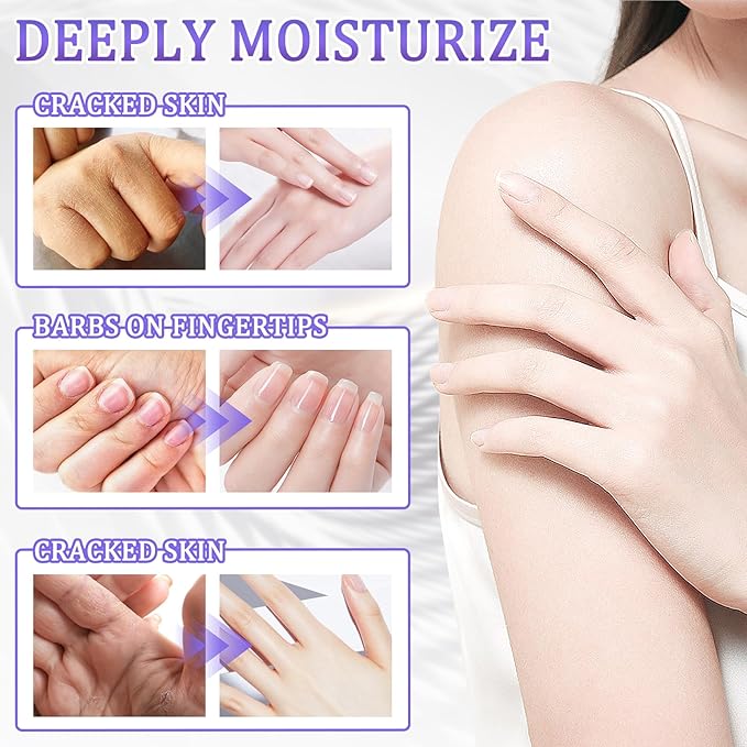Hand Mask Moisturizing Gloves 12 Pack,Hydrating Hand Mask for Women,Soft Gloves for Dry Cracked Skin