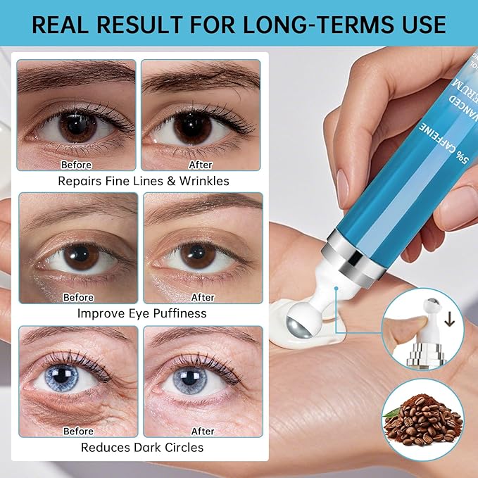 5% Caffeine Eye Cream Anti Aging, Moisturizing Cream For Puffiness & Bags Under Eyes, 2 PCS Caffeine Eye Serum With Under Eyes Roller For Wrinkles, Fine Lines & Dark Circles, Natural Skin Daily Care.