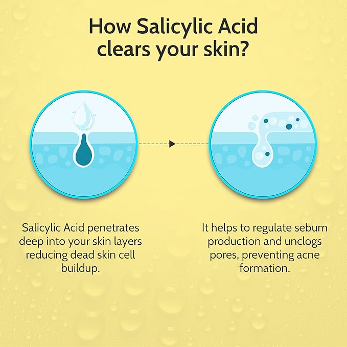 Chemist At Play 2% Salicylic Acid Face Serum | Treats Active Acne | Controls Excess Oil | Fades Acne Marks | Improves Skin Texture | 30ml