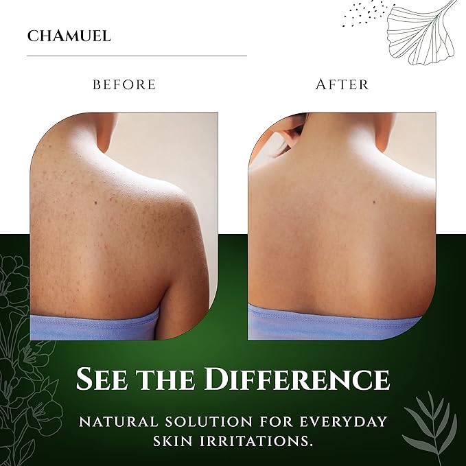 Chamuel Tea Tree Antibacterial Body Wash with Peppermint & Eucalyptus Oil - Natural Daily Shower Gel for Itchy Skin, Body Odor & Foot Care for Men & Women, Non-GMO (11.8oz)