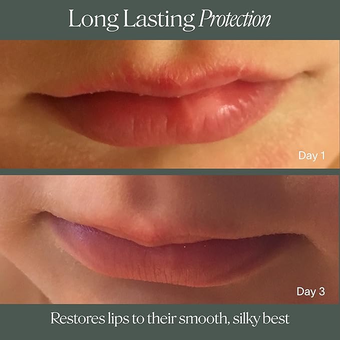 Doctor Rogers Lip Balm, Ultra Hydrating Lip Treatment, Clean Fragrance-free Lip Moisturizer for Soft Lips, Hypoallergenic, 0.15oz (4.25g), Pack of 3 Tubes