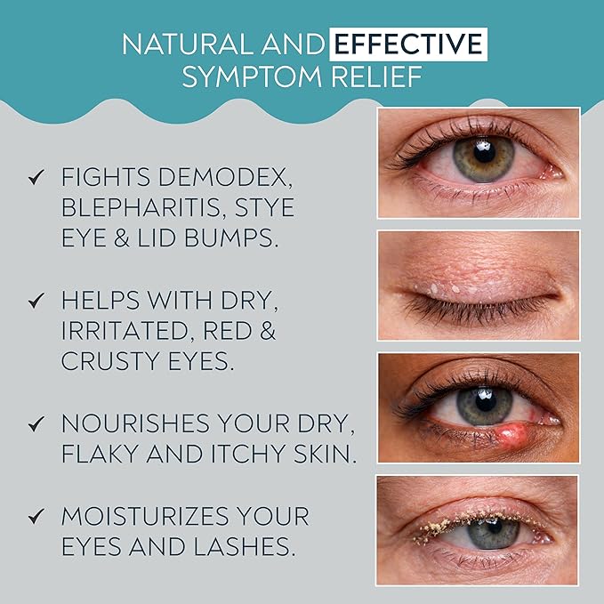 NOVEHA Demodex Eyelid Cleanser Foam | Extra Strength Tea Tree Oil Formula | Daily Face Wash For Eyelash, Demodex, MGD, Stye Eyes, Eye Irritations & Skin Dryness, 3.38 fl. oz. (100ml) - (Pack of 2)