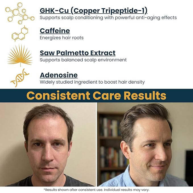 Copper Peptide Serum for Hair Growth - Caffeine, Niacinamide, Rosemary Oil, Saw Palmetto Hair Density Serum, Topical Tripeptide Scalp Care for Hair Thinning, Women & Men 1 fl oz