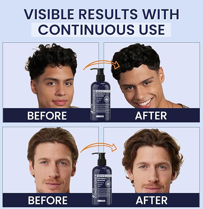 Uttse Biotin Hair Growth Conditioner for Men: Natural Thickening and Volumizing Conditioner with Tea Tree Oil Ginseng Mint for Hair Loss and Thinning Hair - 10.1 fl.oz, Dark Blue