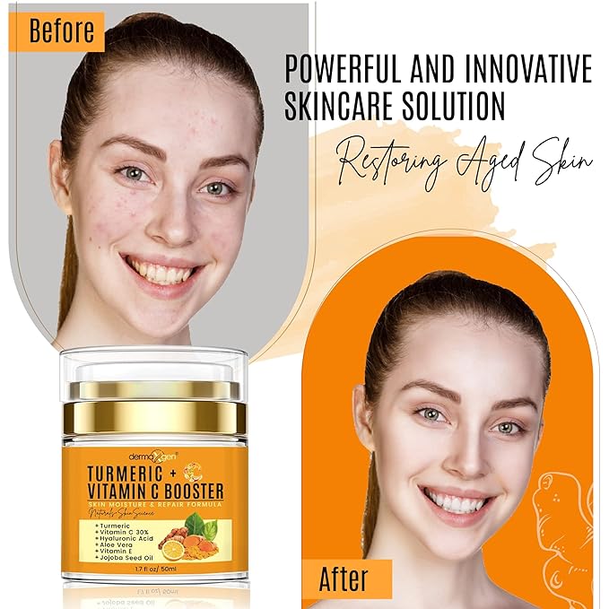 Turmeric Face Cream with 30% Vitamin C – Glow Booster, Anti-Aging & Skin Repair Moisturizer for Dark Spots, Hydration & Radiance – Vitamin C Cream for All Skin Types (1.7 fl oz)