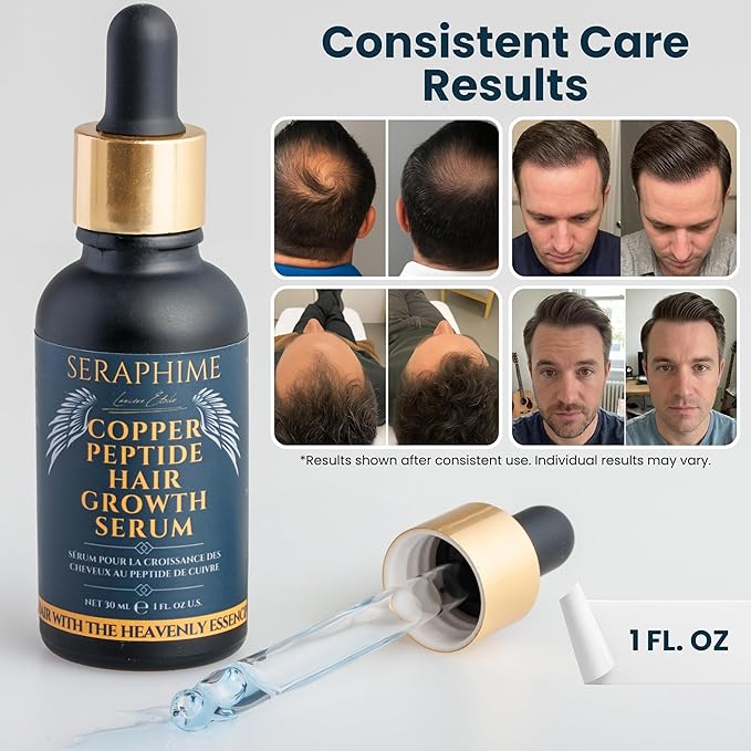 Copper Peptide Serum for Hair Growth - Caffeine, Niacinamide, Rosemary Oil, Saw Palmetto Hair Density Serum, Topical Tripeptide Scalp Care for Hair Thinning, Women & Men 1 fl oz