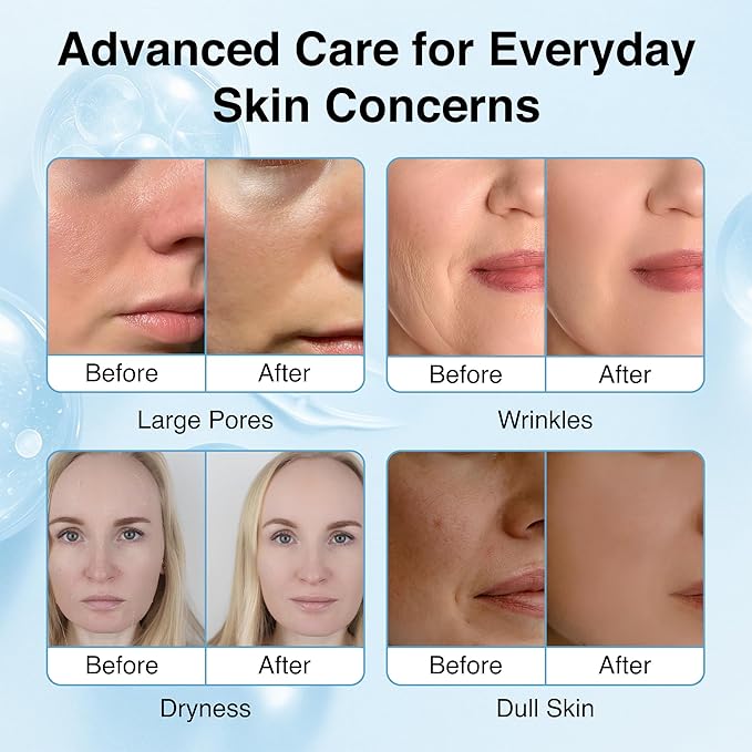 Collagen Face Mask - 6 Pack, Hydrating & Firming Sheet Mask for All Skin Types, Anti-Wrinkle, K-Beauty & Moisturizing Skincare