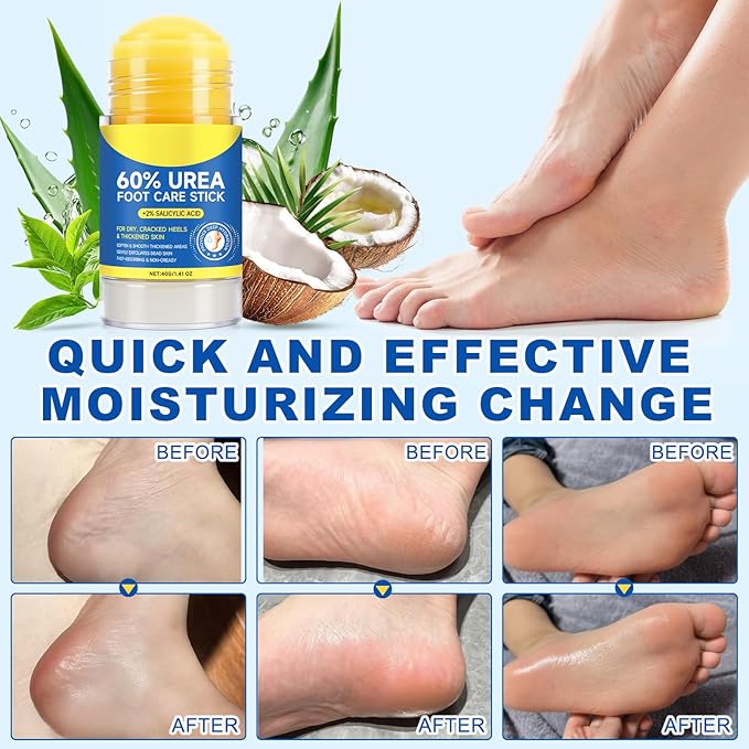 FANSHI Urea Cream 60% Urea Cream 60% Foot Care Stick Deeply Moisturising and Fast Absorbing Gentle Exfoliation for Dry, Cracked Heels & Thickened Skin (3PCS)