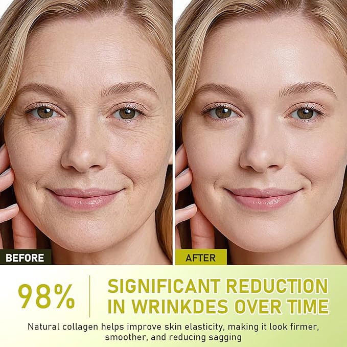 Botoxmix & Vita-A Retinol Shot Wrinkle-Lift Tightening Cream, Vita A Retinal Shot Tightening Booster for Reduces Wrinkles and Fine Lines, Vita-A Retinol Shot for All Skin Types