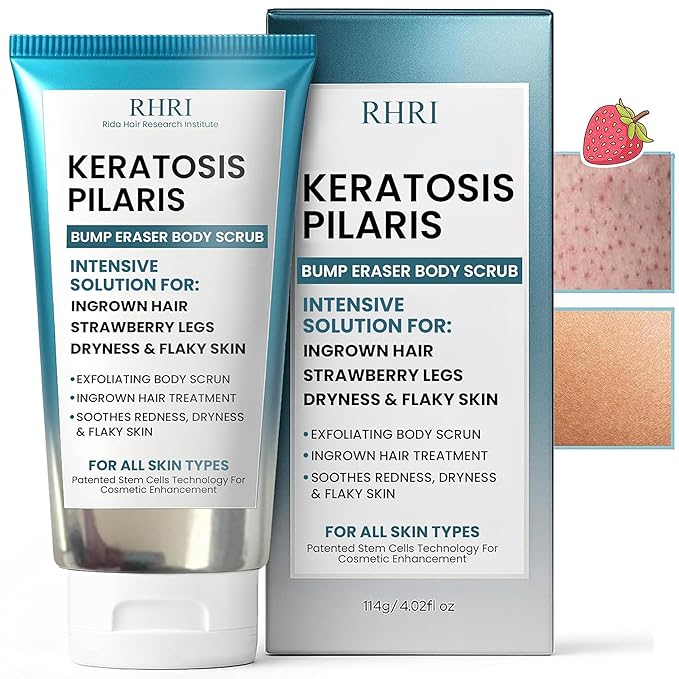 KP Bump Eraser Body Scrub with 10% AHA | Keratosis Pilaris Treatment | Bump Eraser Body Scrub | Ingrown Hair Treatment | Clears Strawberry Legs | Soothes Redness, Dryness & Flaky Skin