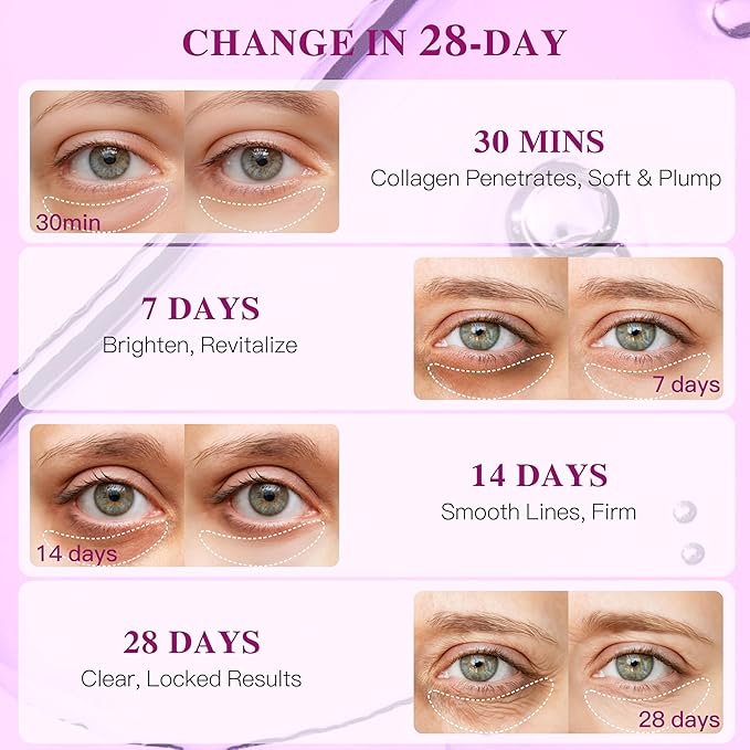 Hyaluronic Acid Collagen Under Eye Patches, Eye Mask for Puffy Eyes and Dark Circles, Deep Hydrating Eye Mask Patches for Eye Bags Treatment, Under-eye Skincare for All-day Moisture (12 pairs)