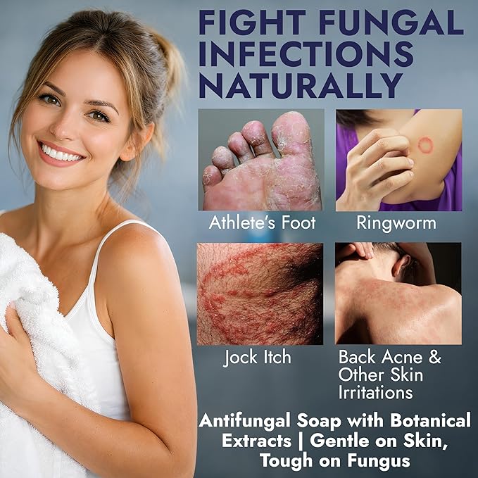 Antifungal Soap Infused with Peppermint Essential Oil | Medicated Tolnaftate 1% Soap for Itchy Skin, Athlete’s Foot, Ringworm & Jock Itch Treatment | Spearmint Freshness Bars Pack of 2 with Scrubber