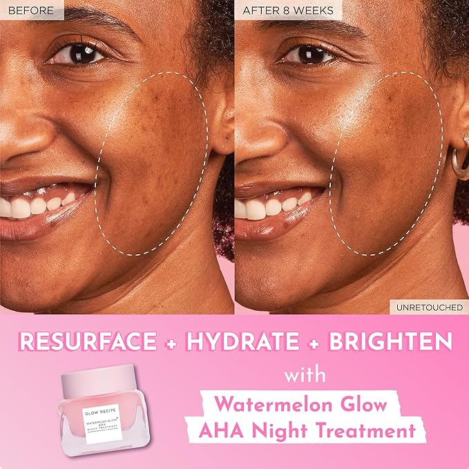 Glow Recipe Watermelon Glow AHA Night Treatment, Travel Size Overnight Mask, AHA Exfoliating Treatment with Glycolic + Lactic Acid, Hyaluronic Acid + Niacinamide, Smooth Even Tone Glow (25 ml)