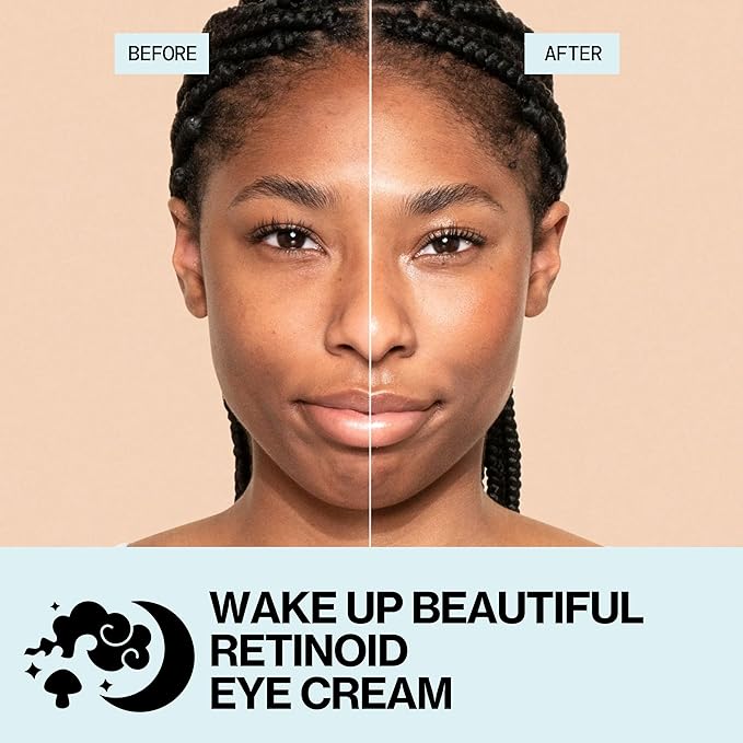 Pacifica Wake Up Beautiful Retinoid Eye Cream – Anti-Aging Under Eye Cream for Fine Lines & Wrinkles, Infused w/Retinoid, Melatonin & Mushrooms for Puffiness, Dark Circles & Eye Bags Daily Treatment