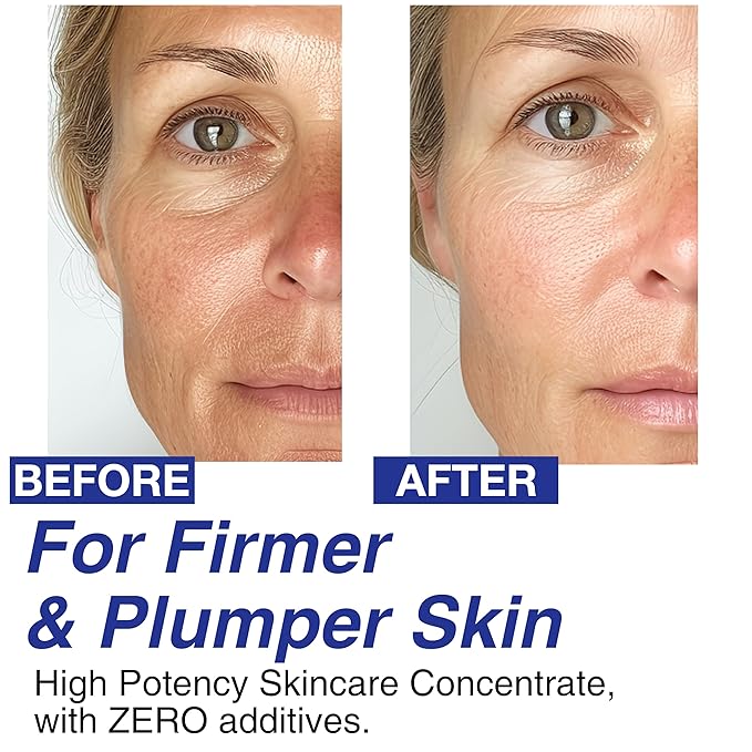 CELDYQUE 100% Pure Volufiline Concentrate Serum 2ea - Skin Firming Solution & Clinically Proven | Anti-Wrinkle, Enhances Facial Contours, Boosts Collagen for Sagging Mature Skin Korean Skincare