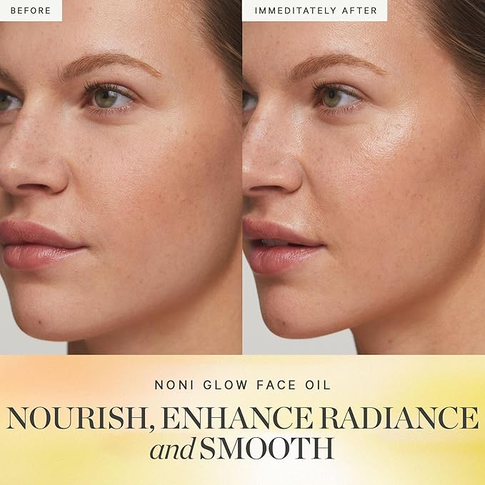 KORA Organics Noni Glow Hydrating Face Oil for All Skin Types, Lightweight Fast-Absorbing Facial Oil with Rosehip, Jojoba & Sea Buckthorn Oils for Smooth & Radiant Looking Skin, 1.01 fl oz