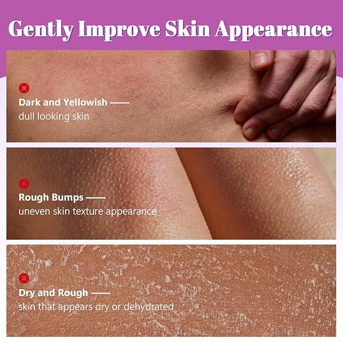 Glycolic Acid Exfoliating Body Stick with 7% AHA & 0.5% BHA – Solid Body Exfoliator for Rough & Bumpy Skin, KP, Dark Spots – No Mess, No Rinse – With Shea Butter