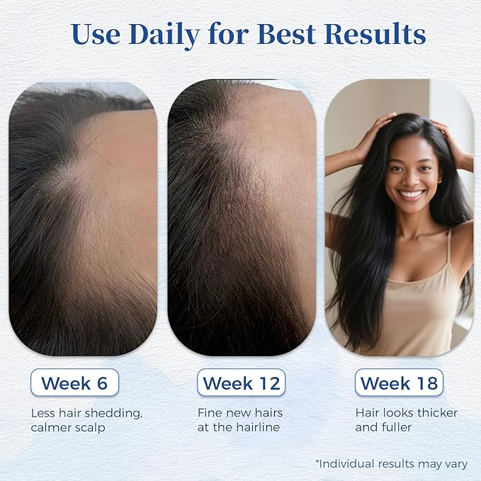 Hair Growth Serum Roll On with Rosemary，Helps Support Thicker, Fuller Hair Appearance，Clean, Non-Greasy Hair Loss Support for Men & Women，Rosemary，0.84 Fl Oz (Pack of 2)