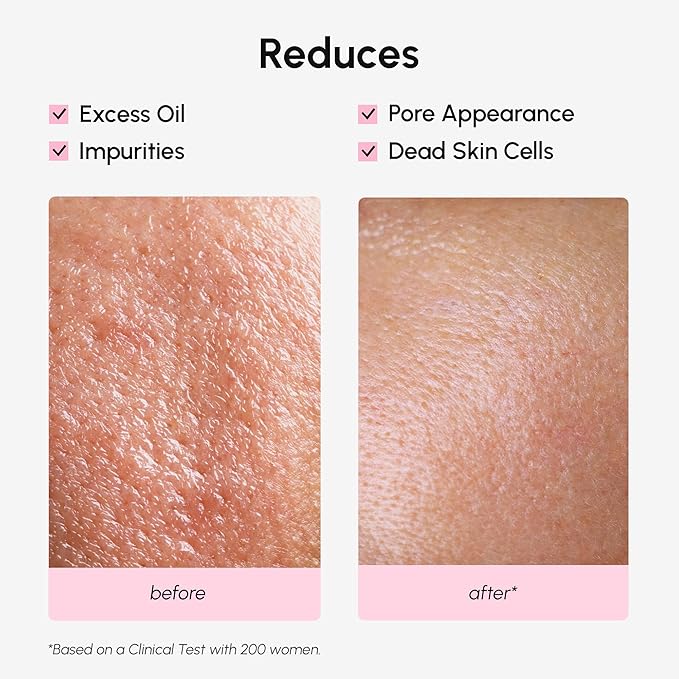 MAREE Pore Minimizer for Face Toner – Witch Hazel Toner with Niacinamide & Marine Collagen – Gentle Exfoliating Oil Control Facial Toner for Women – BHA Liquid Exfoliant – Alcohol Free Tonico Facial