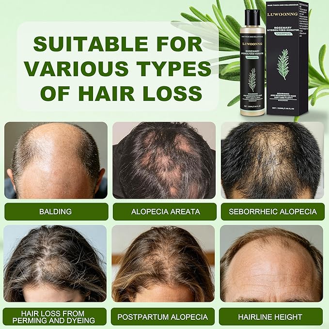 Rosemary Shampoo, Hair Growth Shampoo with Hydrolyzed Keratin, Nourishes Repairs Dry Damaged Thinning Hair, Unisex