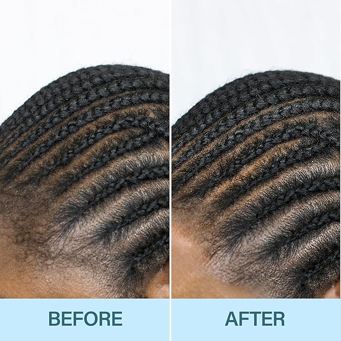 Braid Formula No-Rinse Cleansing Foam - Removes Build-Up, Dirt, Oil from Braids, Twists, Locs | Refresh & Detoxify Scalp | Fast Drying | Stimulate Hair Growth | Apple Cider Vinegar + Biotin Infused