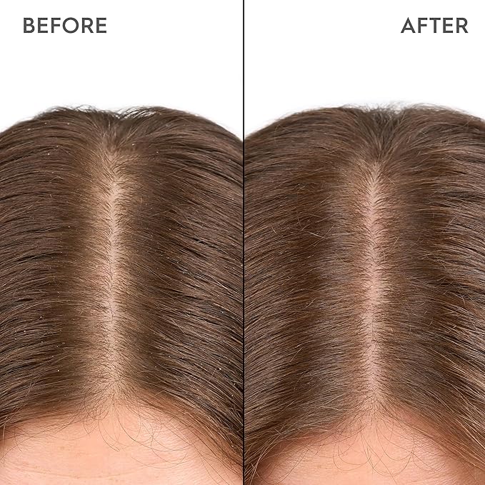 KERASILK Moisturizing Scalp Drops for Dry and Sensitive Scalps, 100ml