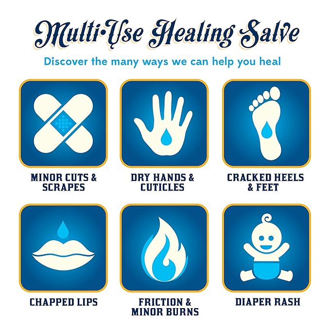Dr. Sayman's Healing Salve – The Original Skin Care Ointment and Protectant/Great for Itchy, Dry and Sensitive Skin/Treats Cracked Feet, Rough Heels and Chapped Lips (4oz.)