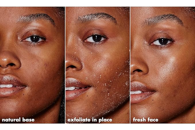 e.l.f. SKIN Gentle Peeling Exfoliant, Cleanser, Effective, Easy to Apply, Peels Away Dead Skin, Removes Dirt, Ideal for All Skin Types