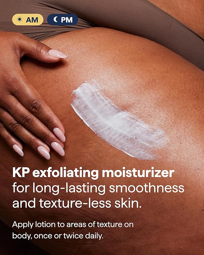 Remedy KP Body Moisturizer | Keratosis Pilaris and Chicken Skin Treatment with Retinol, Urea, Lactic Acid and Ceramides | Exfoliating and Moisturizing Lotion | By Dermatologist Dr. Shah, 7.7 fl oz