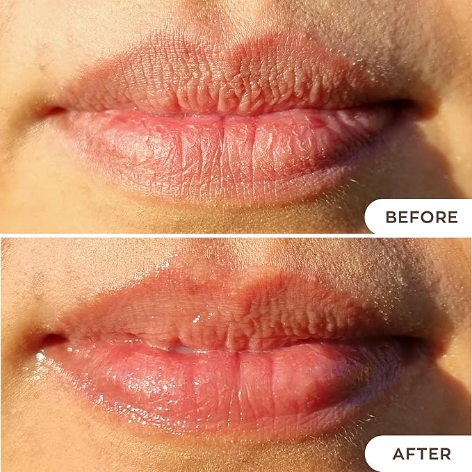 Hanalei Lip Treatment for Dry, Chapped Lips – Intensive Overnight Moisturizer with Kukui Oil, Shea Butter & Grapeseed Oil – Hydrating Balm for Healing Cracks – Mauve Pink Tint, 15g – Cruelty-Free