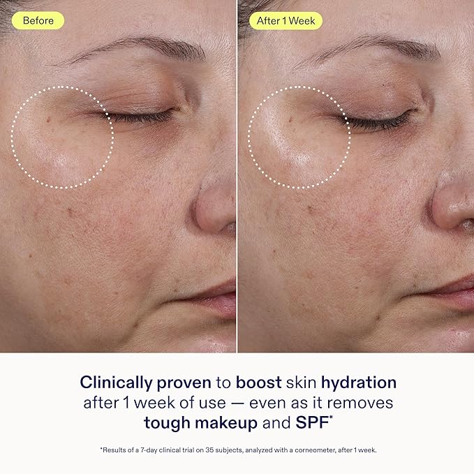 Skinfix Ceramide + Ectoin Gentle Gel Cleanser Mini - 1.5 oz - Removes Makeup & SPF - Cleanses & Hydrates Skin - Vegan, Cruelty Free