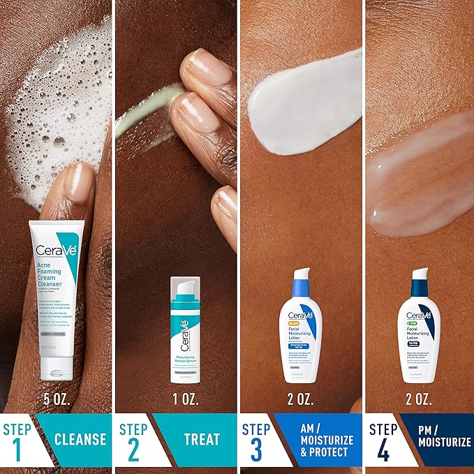 CeraVe Acne Skin Care Set, 5oz Acne Foaming Cream Cleanser + 1oz Resurfacing Retinol Serum + 2oz AM Facial Moisturizing Lotion with SPF 30 + 2oz PM Facial Moisturizing Lotion
