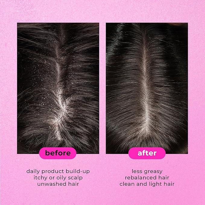 Only4Hair Sea Salt Scrub Shampoo scalp detox treatment