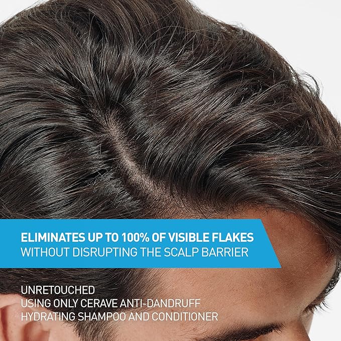 CeraVe Hydrating Anti Dandruff Conditioner,0.5% Pyrithione Zinc Dandruff Treatment With Ceramides,Hyaluronic Acid & Niacinamide,Helps Eliminate Flakes & Reduce Itchy Scalp, Sulfate Free,(Pack of 2)